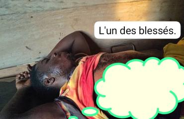 Mambasa : un militaire ivre blesse trois civils par balle avant d'être lynché à Biakato