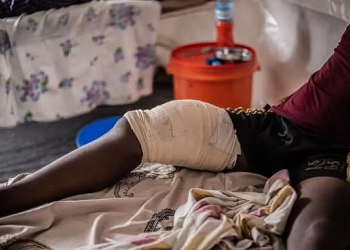 Le CICR soigne près de 2 300 blessés par arme au Nord et Sud-Kivu